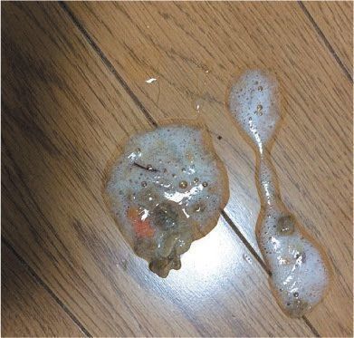 画像付き 猫が吐く理由は 危険な嘔吐物の特徴や見極め方も ねこのきもちweb Magazine